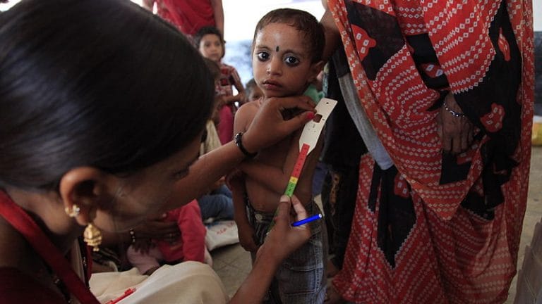 2.5 crore Indian kids underweight due to malnutrition: Global report
