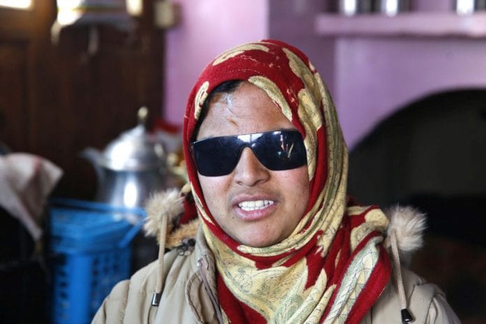 Insha Mushtaq, a victim of pellet shots in Kashmir.