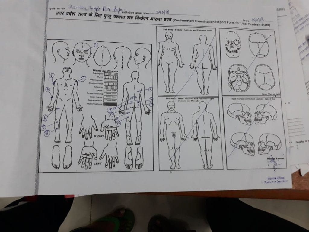 Unnao Rape victim postmortem