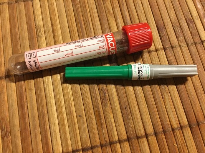 Representational image | Pxhere