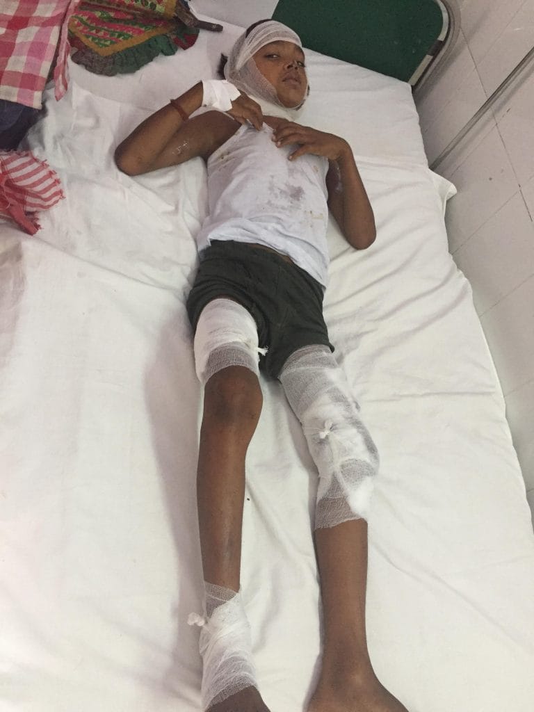 Latest news on Sitapur's dog attacks | ThePrint.in