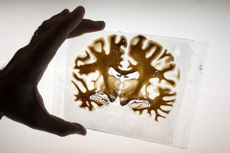 Indian study learns how brain handles sudden distractions, could help create mental health tools