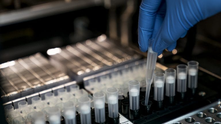 Priced at $5 and taking just minutes, new antigen test in US could be Covid ‘game-changer’