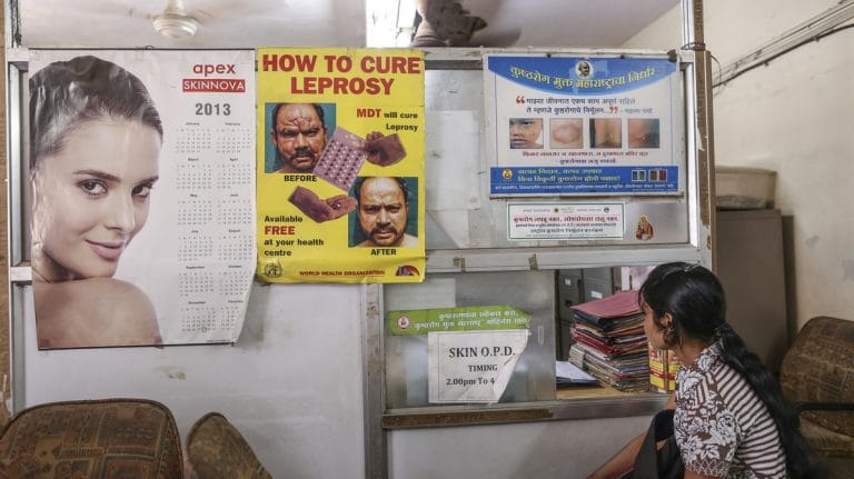 Leprosy no longer grounds for divorce, but a long way to go before stigma is removed