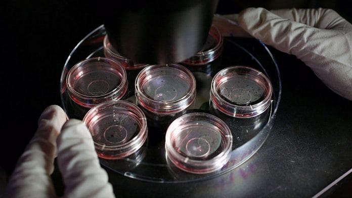 A scientist positions human 'ES' cell-derived cardiomyocytes for viewing under a microscope (representational image) | Bloomberg