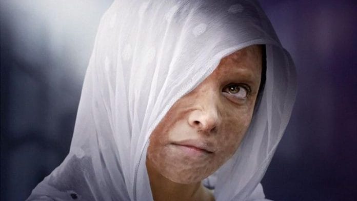 A still from the movie Chhapaak