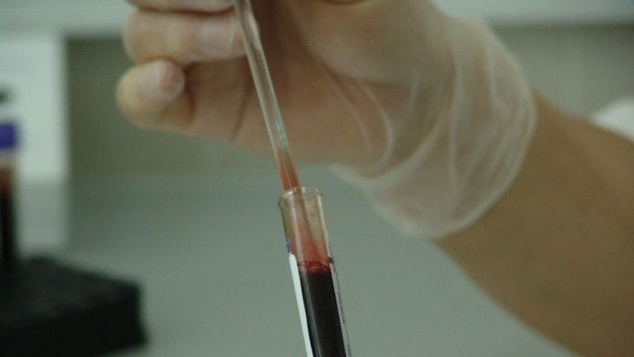 blood samples being examines
