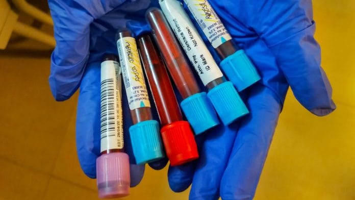 Testing for Covid-19 remains a task for countries that are looking to scale up their testing capacity | Representational image | PTI