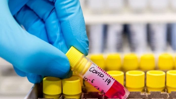 Representational image | Bloomberg