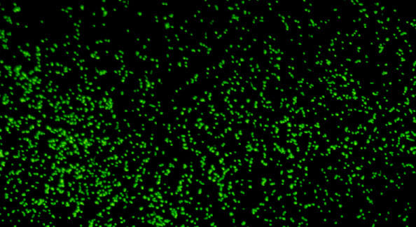 Magnified image showing microbes revived from 101.5 million-year-old sediment | Image: JAMSTEC