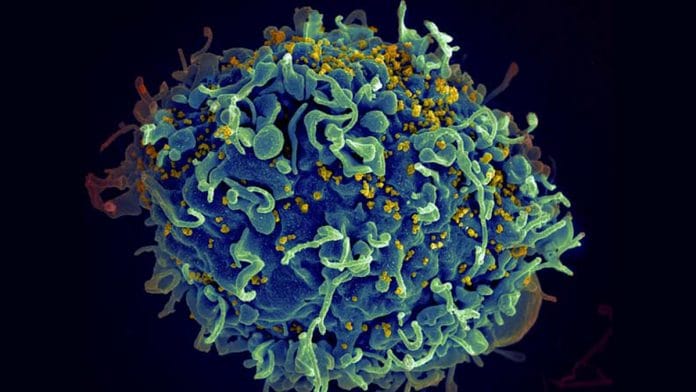 Human T cell (blue) under attack by HIV (yellow), the virus that causes AIDS | Credits: www.nih.gov