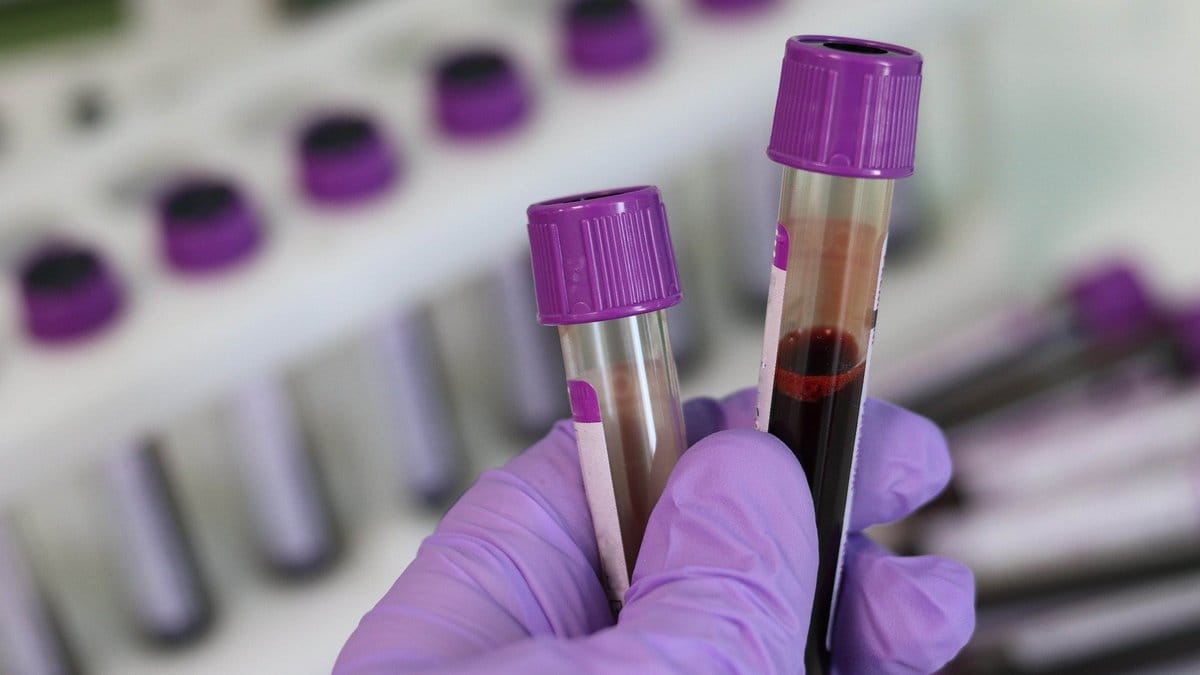 UK to trial ‘game-changer’ blood test that ‘may detect 50 types of ...