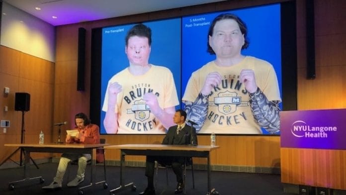 Joe DiMeo at the NYU Langone Health after his successful face and double hand transplant. | Photo: Twitter/@nyulangone