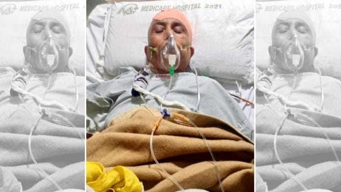 In patient Kala Bai’s case, the white fungus was found to be the size of 8.4 X 4 X 4.6 cm by volume | By special arrangement