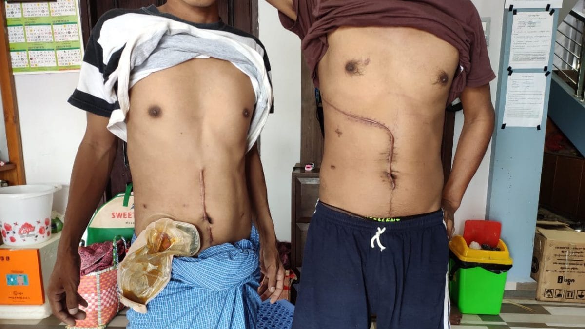 Two of the three men who were fired upon at a jewellery store in Tamu, Myanmar | Photo: Simrin Sirur/ThePrint