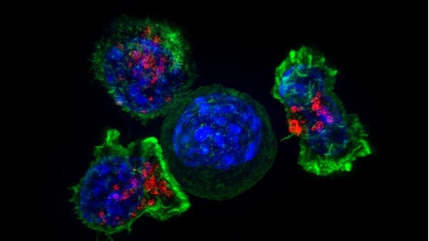 Superresolution image of a group of killer T cells (green and red) surrounding a cancer cell (blue, center)