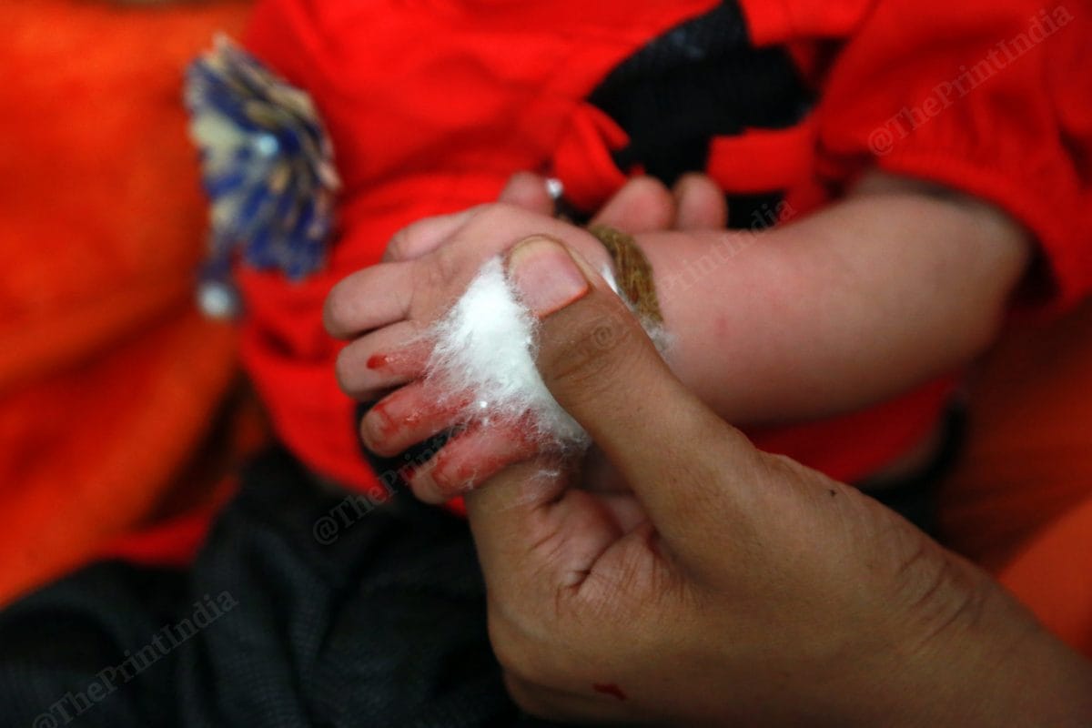 A mysterious disease claimed the lives of children in Uttar Pradesh's Firozabad district in the month of September. In this picture blood was drawn from a infants hand | Photo: Manisha Mondal | ThePrint