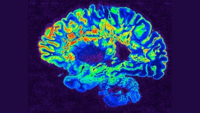 Representational image | Flickr