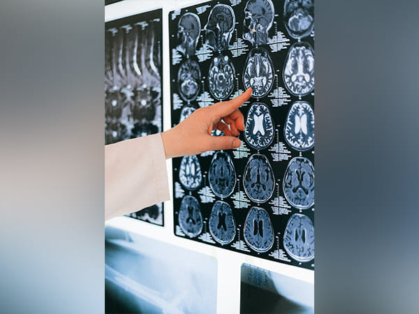 Study finds brain region responsible for effortful altruistic behaviour in people 