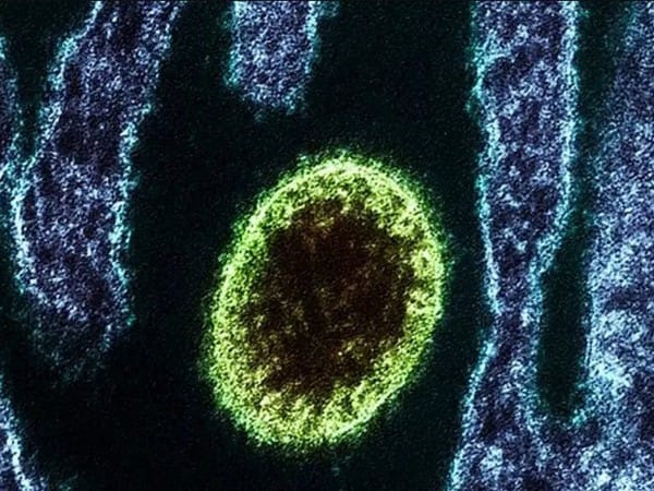Zoonotic Langya virus found in China, 35 infected so far 