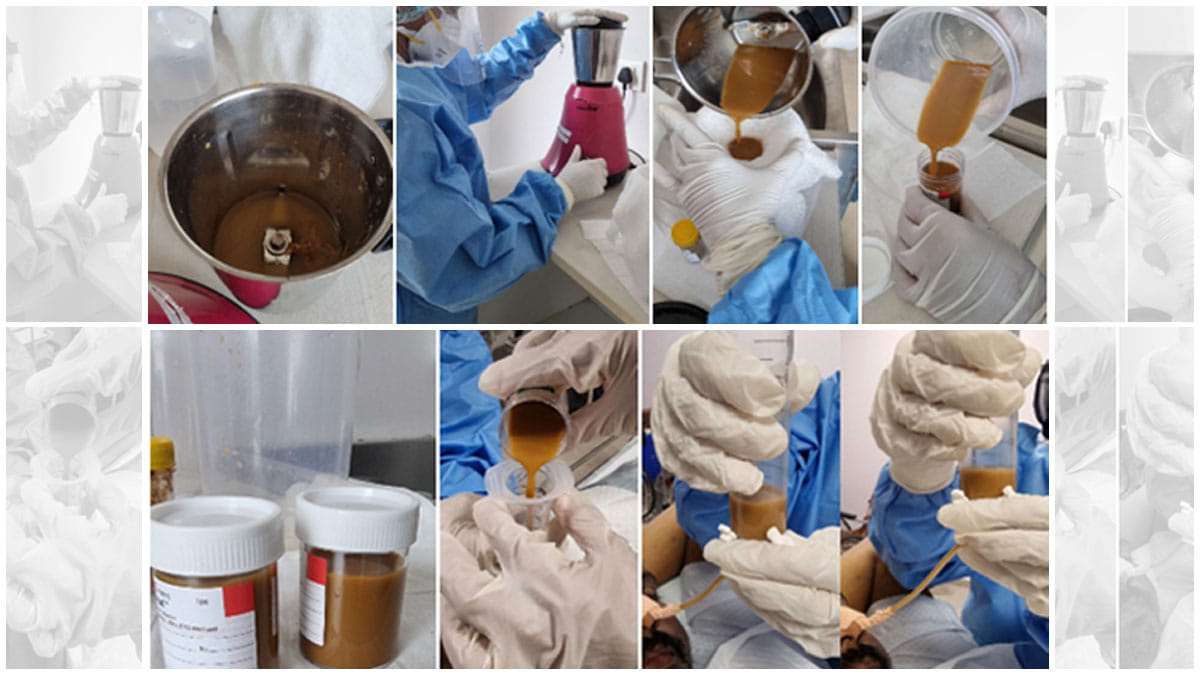 Faecal Microbiota Transplant | Image courtesy: Dr Cyriac Abby Philips / Rajagiri Hospital, Kerala