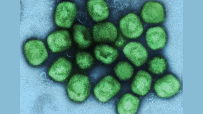 Colorised transmission electron micrograph of monkeypox virus particles | Representational image | Flickr