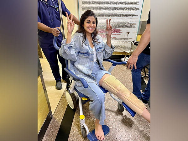 Shilpa Shetty breaks her leg on sets of Rohit Shetty's 'Indian Police Force'