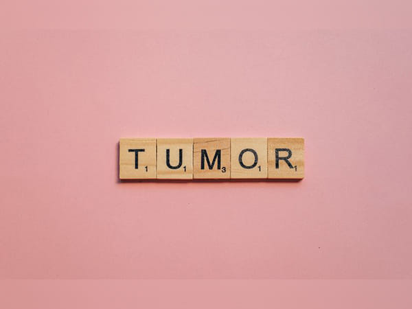 Scientists discover new device to measure changing size of tumors below skin