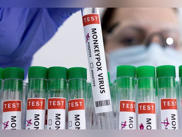 Mainland China reports first monkeypox case in Chongqing city 