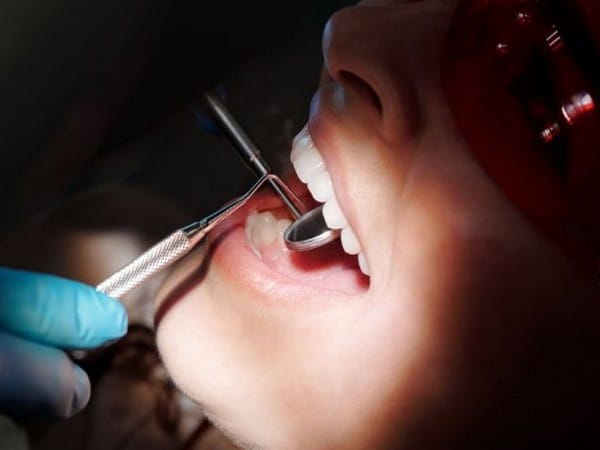 Research suggests improved mineralized material can restore tooth enamel