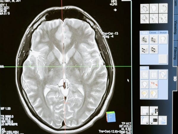 Investigating factors behind consciousness issues