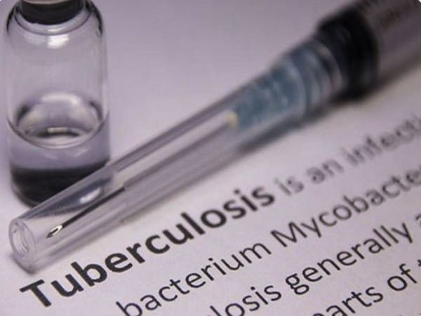 Tuberculosis cases surged for the first time in many years: WHO
