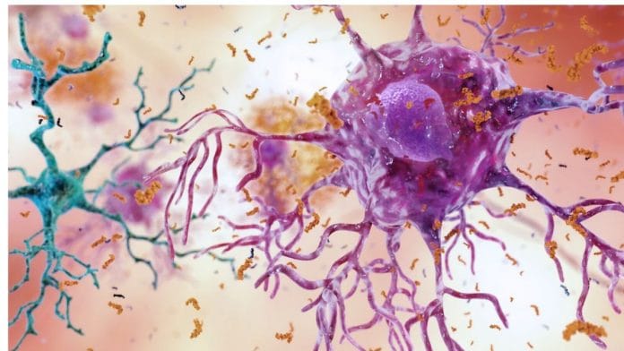 Representational image