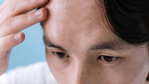 Study: Skin diseases changes molecular, microbial composition of human skin