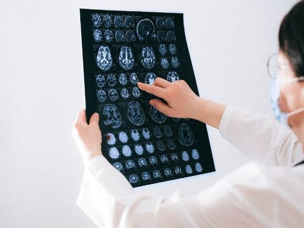 Research: Thyroid problems linked to increased risk of dementia