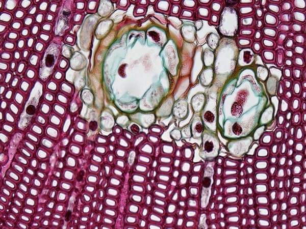 Research reveals how fatty acids are absorbed by singular cells