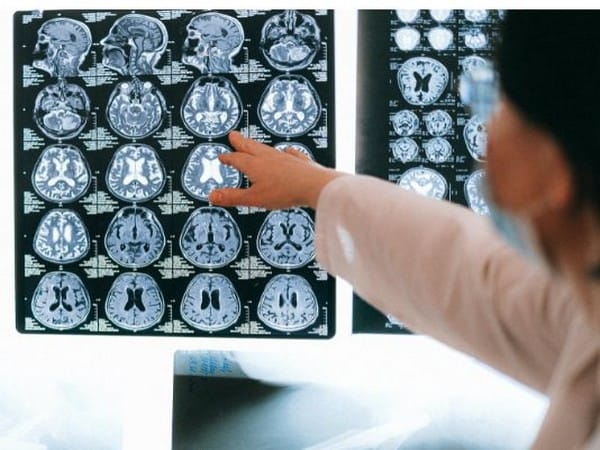 Early intervention effective in treating neurodevelopmental disorders: Study