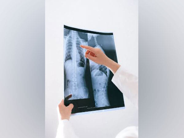 Research shows how signals affect mucus production in lungs