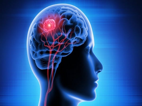 Researchers reveal head injury linked with doubled mortality rate in long term