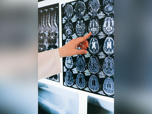 Traffic pollution affects brain function: Study