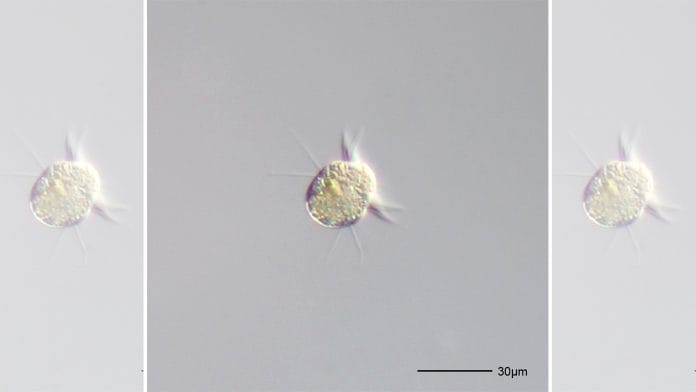 Halteria grandinella | Representational image | Commons