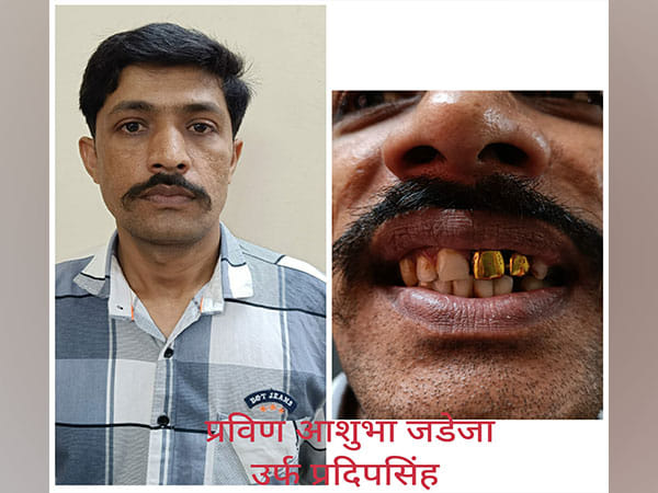 Mumbai Police arrests fugitive on run for 15 years; identify him from his gold teeth