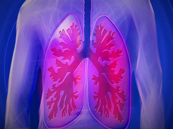New lung health study identifies importance of early-life factors