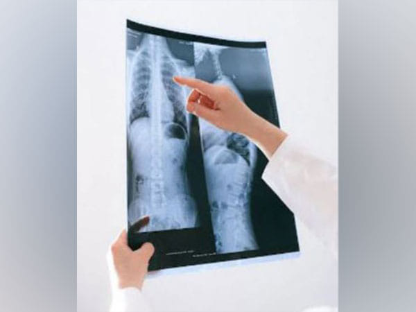 Childhood respiratory illness linked with higher risk of death in adulthood: Research