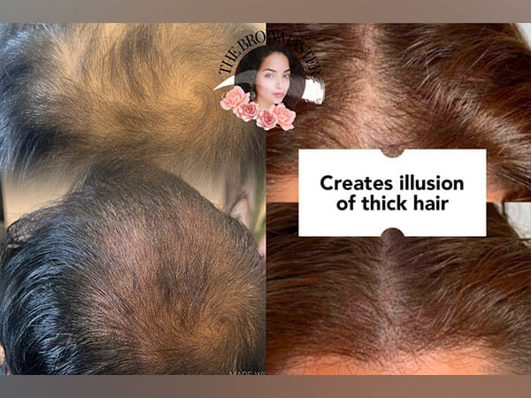 BrowMaster Now Offering Scalp Micro Pigmentation (SMP) Services in India