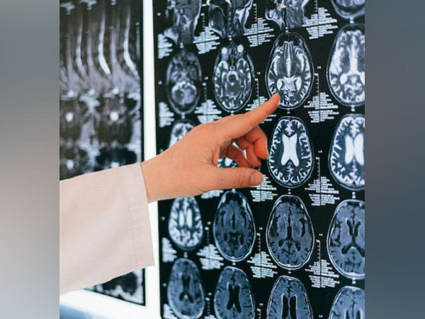 Researchers 'see' how the brain adapts to different situations using machine learning