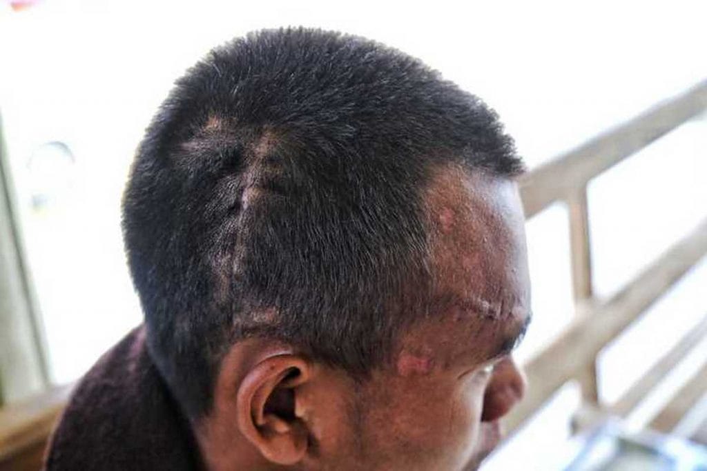 Thangboi, Kuki victim