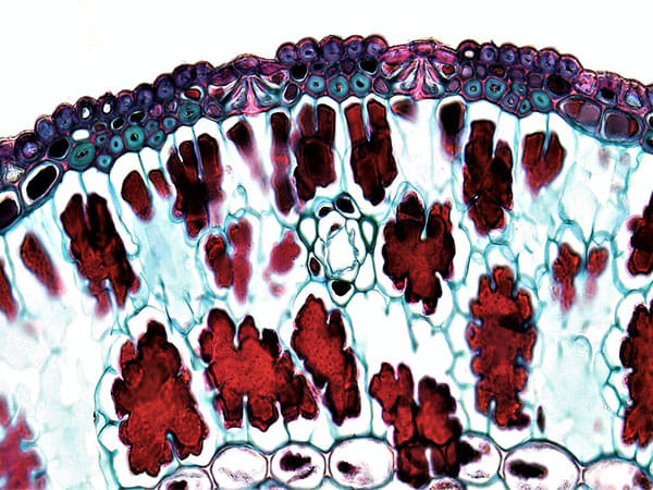 Base editing can be preferable in curing sickle cell disease: Study