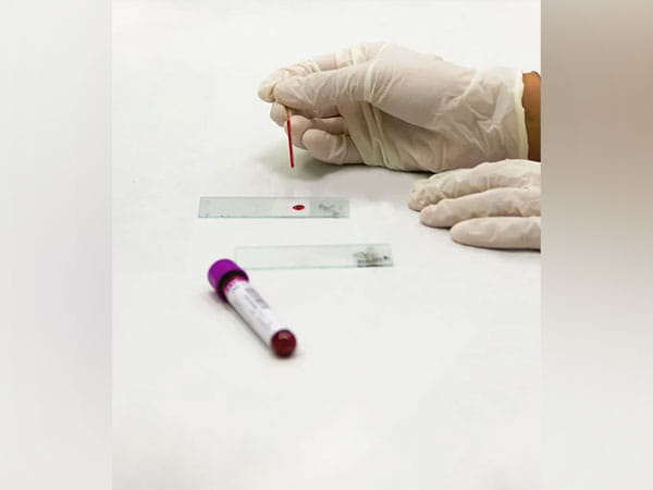 Digital pathology set to be game changer in medical industry