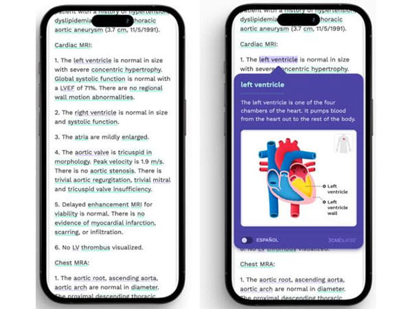 Aarthi Scans introduces Smart Reports for MRI and CT Scans